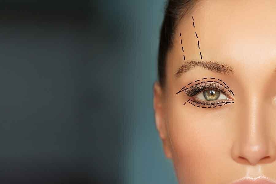 Facial Fat Grafting Facts  Charlotte