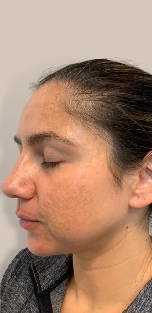 Skin Care Before & After Image