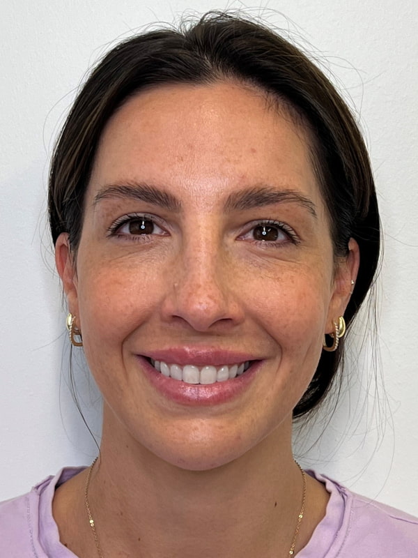 Chin Filler Before & After Image